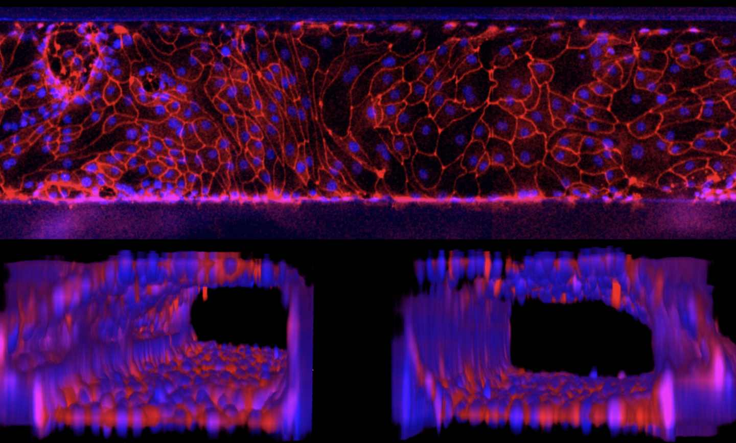 Organoids-on-a-chip