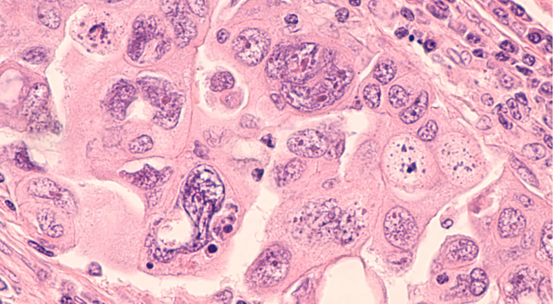 Ovarian cancer organoids