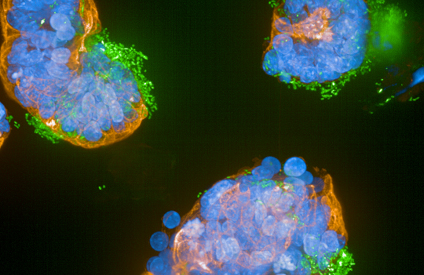 tumor-organoid.png