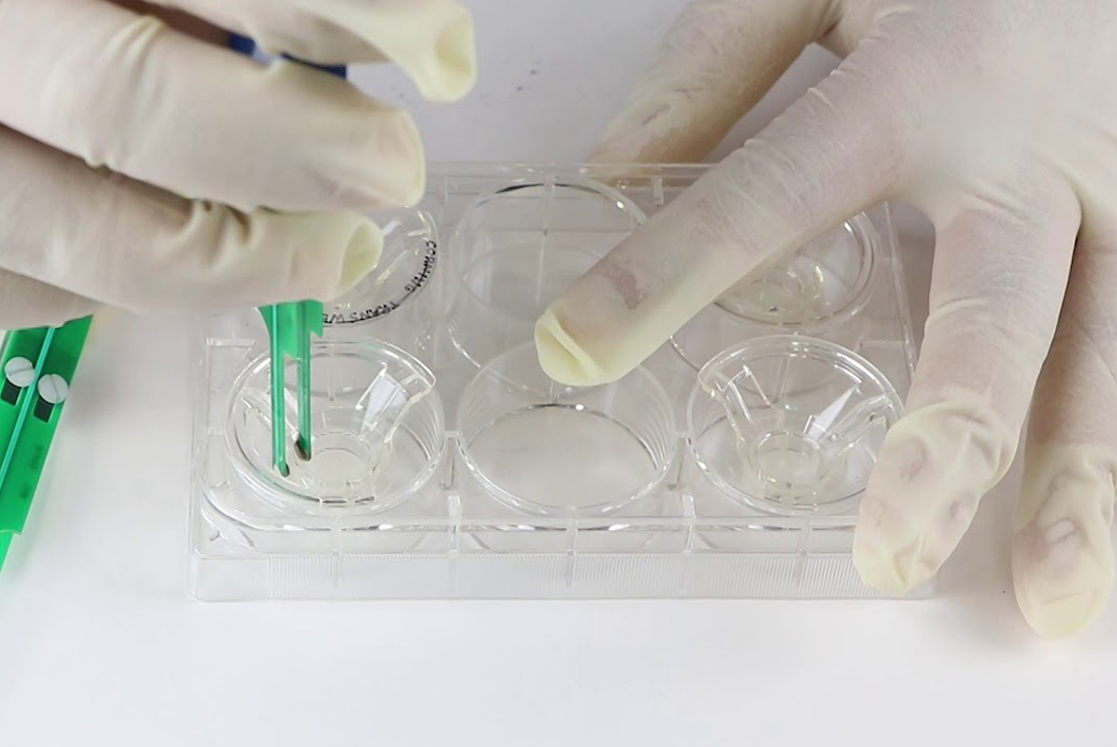 PDO Monolayer for evaluating gut epithelial barrier function in IBD research