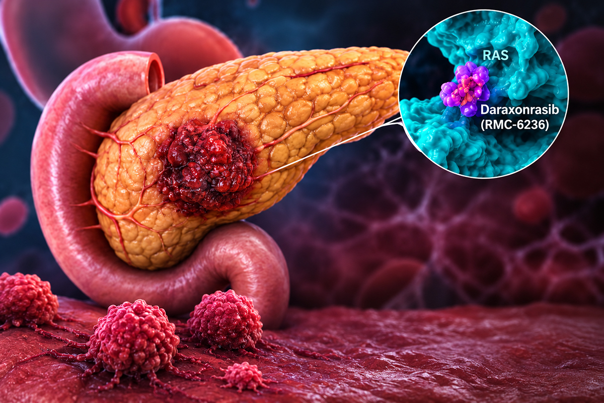 RASolute 302 Trial: A New Era for RAS-Targeted Drug Discovery